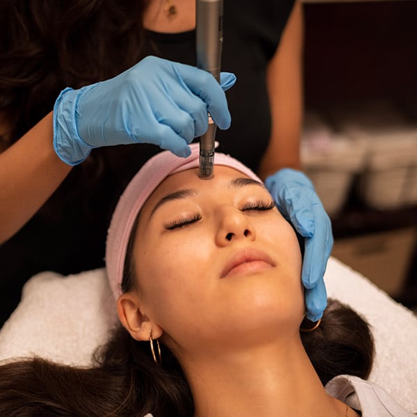 Close up of microneedling being performed at Beauty on Broadway