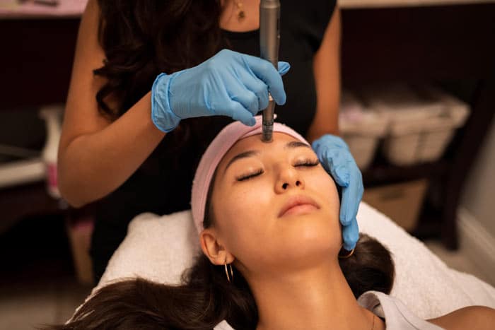 Microneedling service being performed at Beauty on Broadway